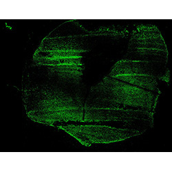 11PCW human midbrain